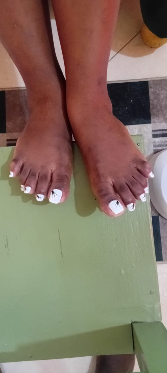 White pedicure with black art